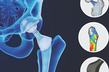 Design Implants Leveraging Additive Manufacturing